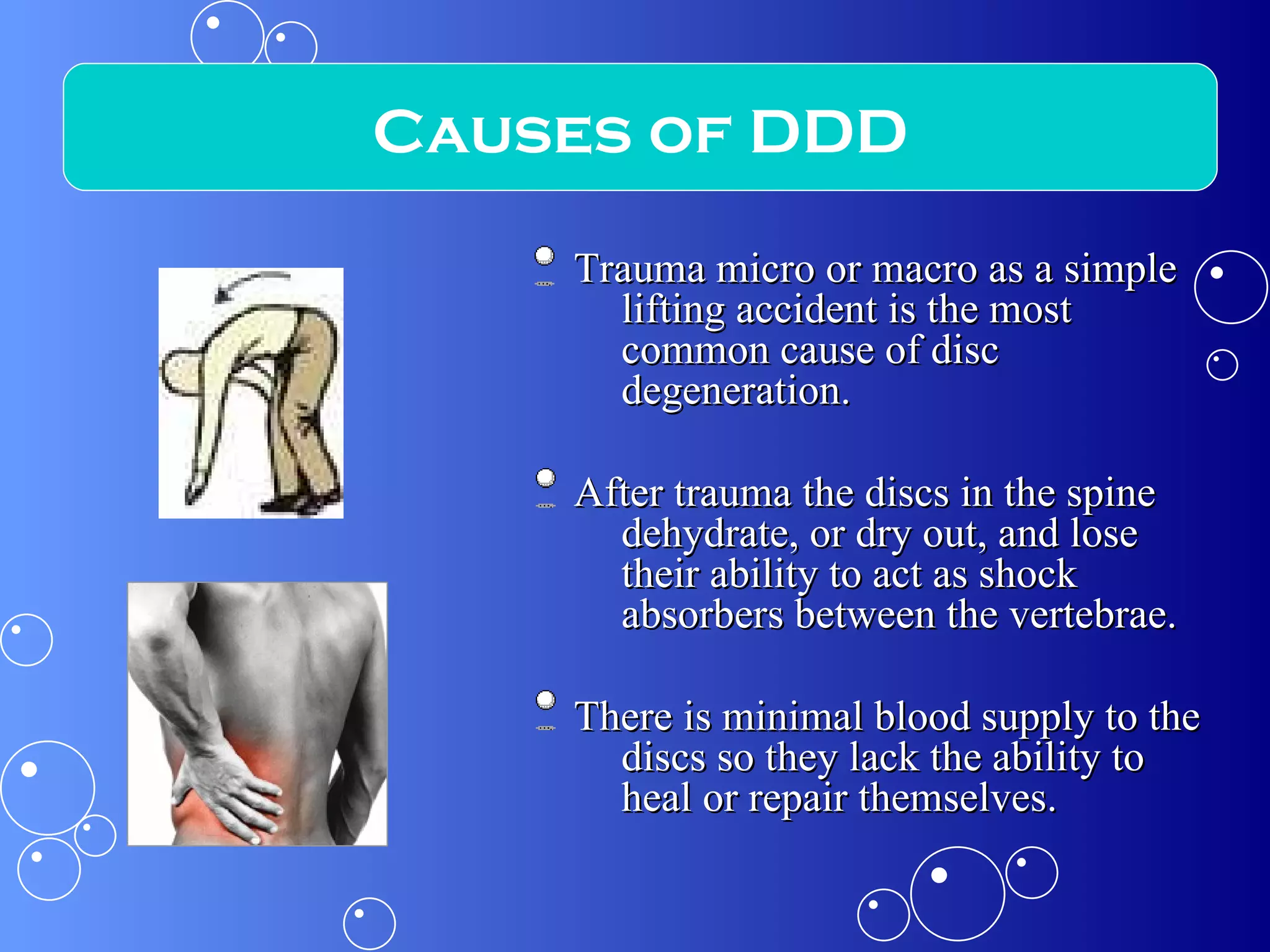 Trauma micro or macro as a simple lifting accident is the most common cause of disc degeneration.  After trauma the discs in the spine dehydrate, or dry out, and lose their ability to act as shock absorbers between the vertebrae.  There is minimal blood supply to the discs so they lack the ability to heal or repair themselves. Causes of DDD 