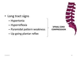 • Long tract signs
– Hypertonia
– Hyperreflexia
– Pyramidal pattern weakness
– Up going plantar reflex
SPINAL CORD
COMPRESSSION
1/9/2013 43
 