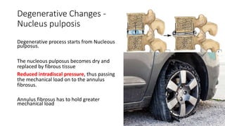 Degenerative Changes -
Nucleus pulposis
Degenerative process starts from Nucleous
pulposus.
The nucleous pulposus becomes dry and
replaced by fibrous tissue
Reduced intradiscal pressure, thus passing
the mechanical load on to the annulus
fibrosus.
Annulus fibrosus has to hold greater
mechanical load
 