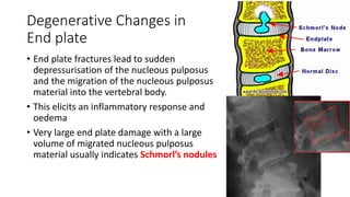 Degenerative Changes in
End plate
• End plate fractures lead to sudden
depressurisation of the nucleous pulposus
and the migration of the nucleous pulposus
material into the vertebral body.
• This elicits an inflammatory response and
oedema
• Very large end plate damage with a large
volume of migrated nucleous pulposus
material usually indicates Schmorl’s nodules
 