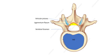 Ligamentum flavum
Articular process
IVD
Vertebral foramen
 