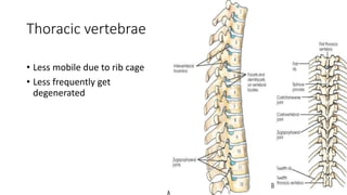 Thoracic vertebrae
• Less mobile due to rib cage
• Less frequently get
degenerated
 