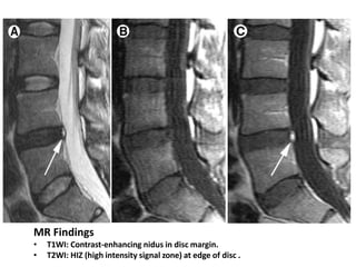 Degenerative Spine Diseases.ppt