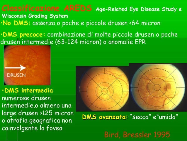 Degenerazione Maculare Senile
