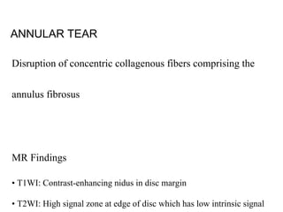 Imaging in degenerative diseases of spine | PPTX