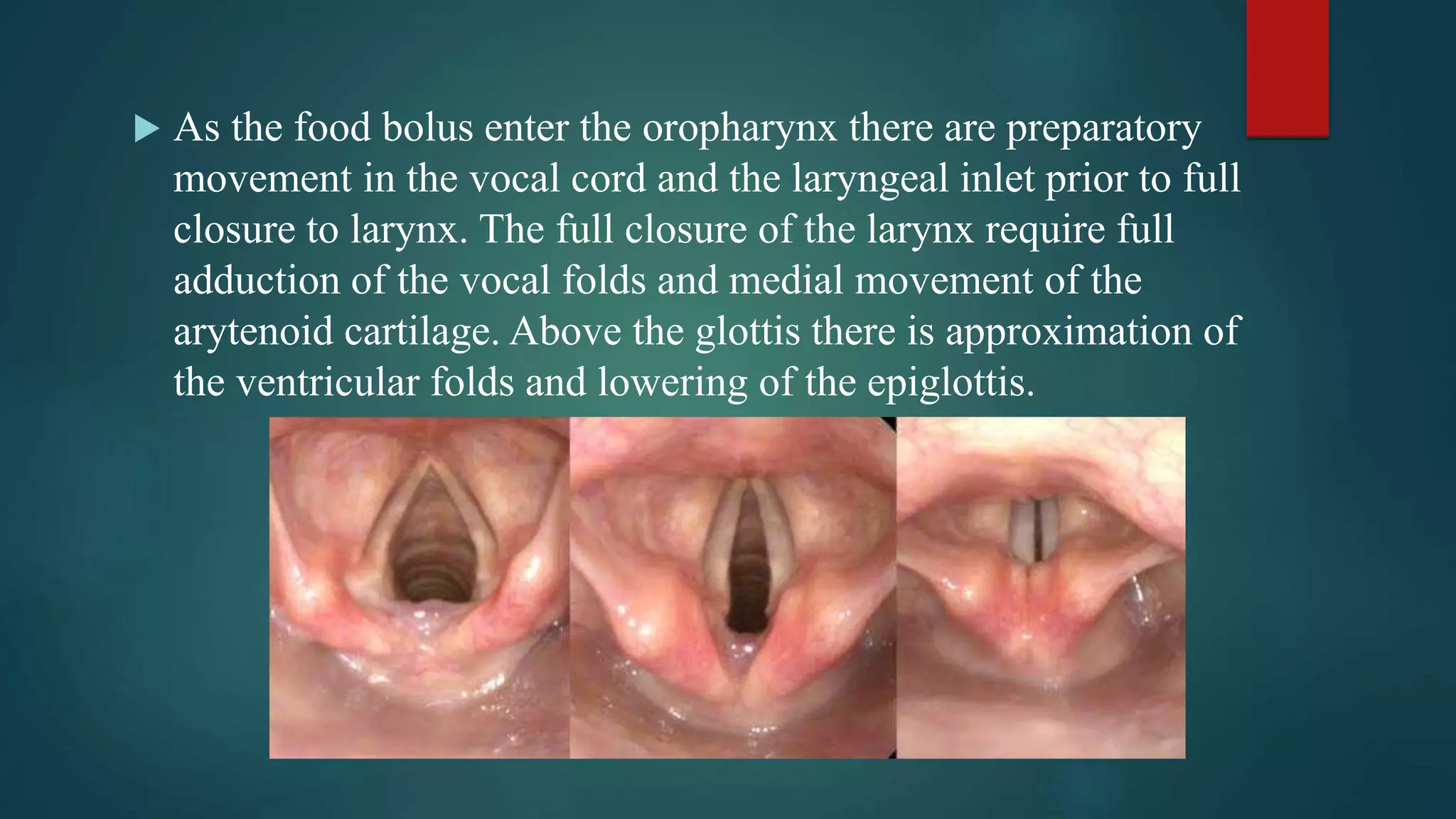 As the food bolus enter the oropharynx there are preparatory
movement in the vocal cord and the laryngeal inlet prior to full
closure to larynx. The full closure of the larynx require full
adduction of the vocal folds and medial movement of the
arytenoid cartilage. Above the glottis there is approximation of
the ventricular folds and lowering of the epiglottis.
 