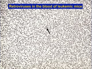 Retroviruses in the blood of leukemic mice




                       Questioning the Existence of HIV, E. de Harven
 