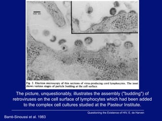 The picture, unquestionably, illustrates the assembly ("budding") of
     retroviruses on the cell surface of lymphocytes which had been added
           to the complex cell cultures studied at the Pasteur Institute.
                                          Questioning the Existence of HIV, E. de Harven
Barré-Sinoussi et al. 1983
 