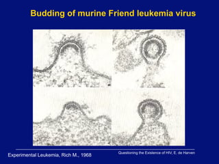 Budding of murine Friend leukemia virus




                                       Questioning the Existence of HIV, E. de Harven
Experimental Leukemia, Rich M., 1968
 