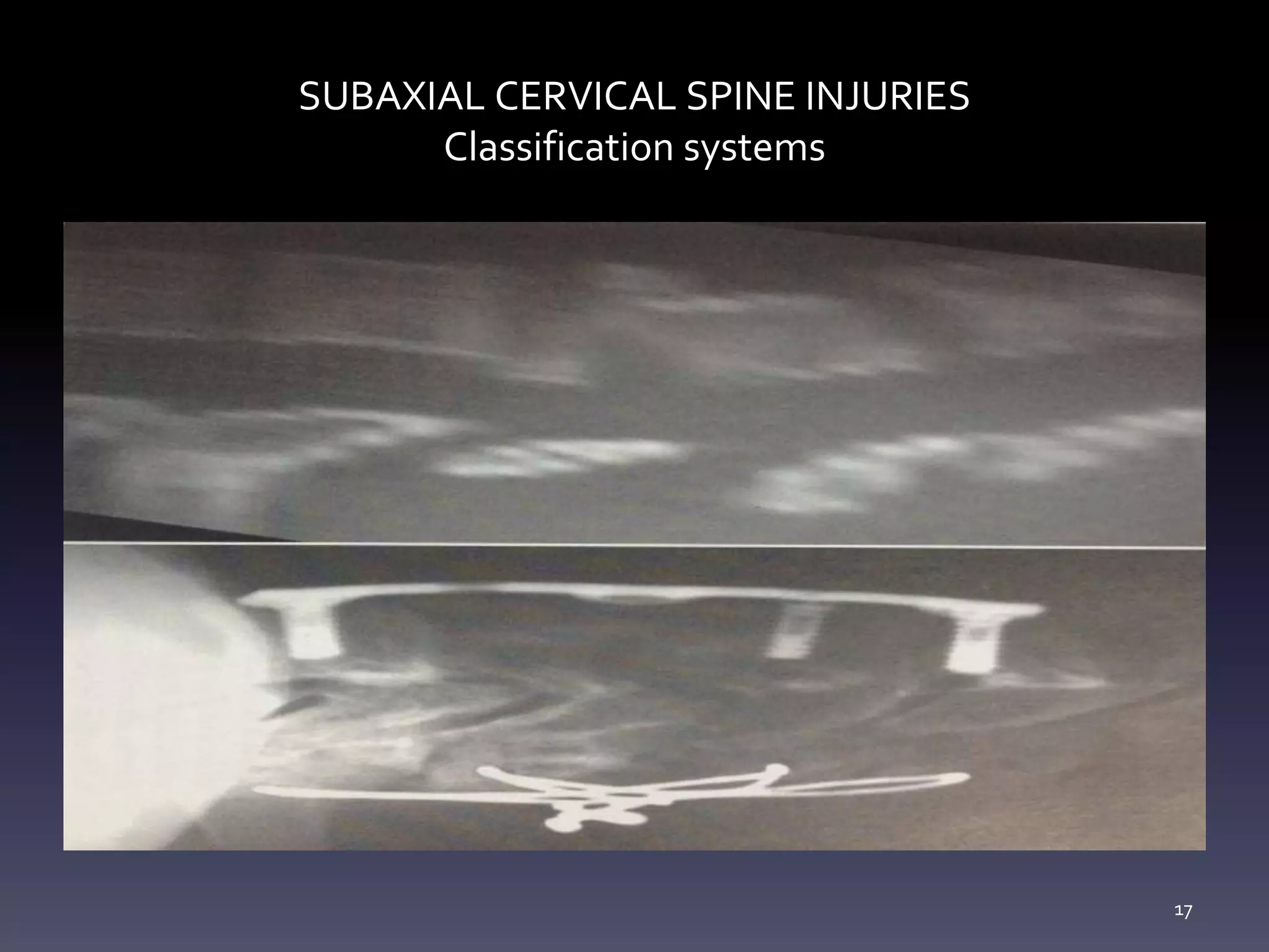 Subaxial Cervical Spine Injuries | PPTX
