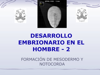 DESARROLLO EMBRIONARIO EN EL HOMBRE - 2 FORMACIÓN DE MESODERMO Y NOTOCORDA 