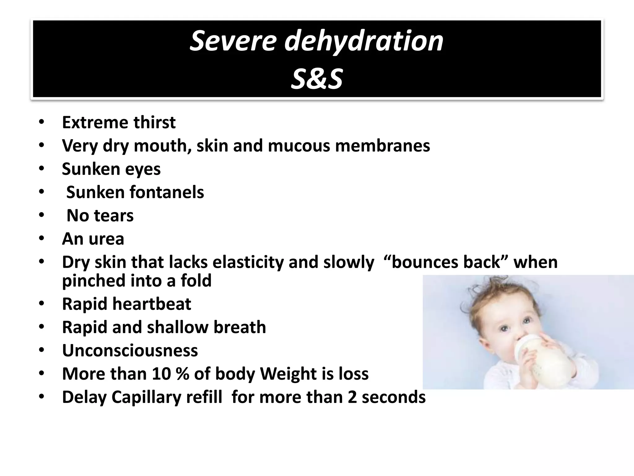 Dehydrated child (TUCOM) | PPTX