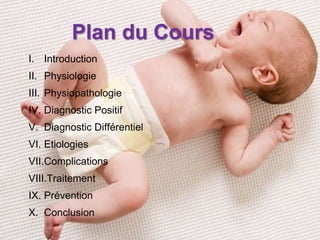 Deshydratation Aigue Du Nourrisson