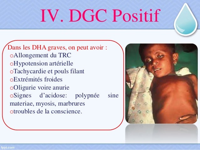 Deshydratation Aigue Du Nourrisson