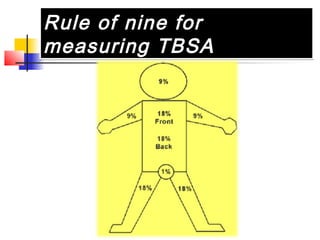 Rule of nine for
measuring TBSA
Rule of nine for
measuring TBSA
 