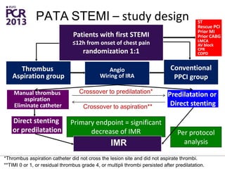 Per protocol
analysis
Manual thrombus
aspiration
Eliminate catheter
Predilatation or
Direct stenting
Primary endpoint = significant
decrease of IMR
Patients with first STEMI
≤12h from onset of chest pain
randomization 1:1
PATA STEMI – study design
IMR
Direct stenting
or predilatation
*Thrombus aspiration catheter did not cross the lesion site and did not aspirate thrombi.
Crossover to predilatation*
**TIMI 0 or 1, or residual thrombus grade 4, or multipli thrombi persisted after predilatation.
Crossover to aspiration**
Conventional
PPCI group
Thrombus
Aspiration group
Angio
Wiring of IRA
ST
Rescue PCI
Prior MI
Prior CABG
LMCA
AV block
CPR
COPD
 