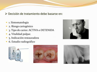  Decisión de tratamiento debe basarse en:

 1. Sintomatología
 2. Riesgo cariogénico
 3. Tipo de caries: ACTIVA o DETENIDA
 4. Vitalidad pulpar.
 5. Indicación restauradora
 6. Estudio radiográfico
 