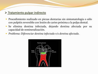 Tratamiento pulpar indirecto
 Procedimiento realizado en piezas dentarias sin sintomatología o sólo
  con pulpitis reversible con lesión de caries próxima a la pulpa dental.
 Se elimina dentina infectada, dejando dentina afectada por su
  capacidad de remineralización.
 Problema: Diferenciar dentina infectada v/s dentina afectada.
 