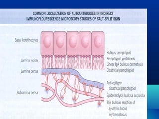 Dermo epidermal junction