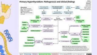 Comprehensive Overview of Hyperthyroidism: Definition, Diagnosis, and ...