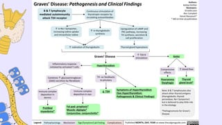 Comprehensive Overview of Hyperthyroidism: Definition, Diagnosis, and ...