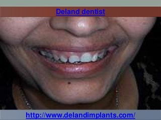 Deland dentist

http://www.delandimplants.com/

 