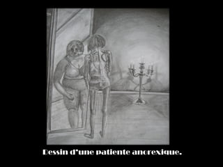 Dessin d’une patiente anorexique.
 