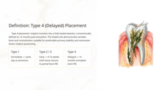 Delayed Implant Placement and Conventional Loading: Biological ...