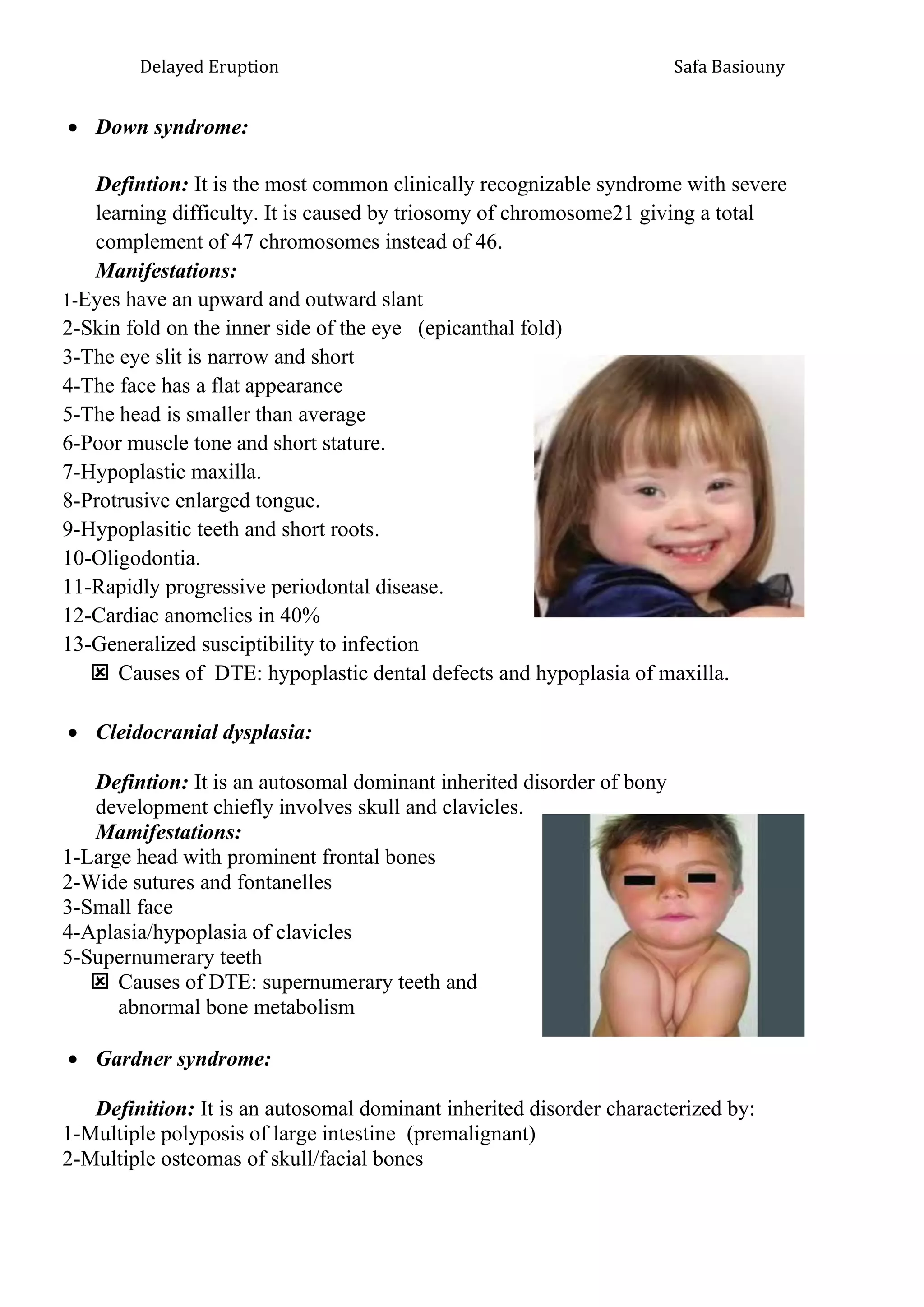 delayed eruption in dentistry.pdf