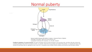 Normal puberty
 