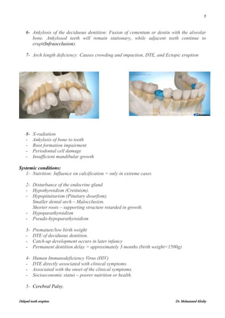 Delayed Tooth Eruption and its clinical effects | PDF