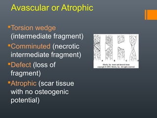 Fragment Defect Delayed Union & Nonunion of Fractures | PPT