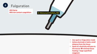 Fulgurated electrosurgery Part 01.pdf