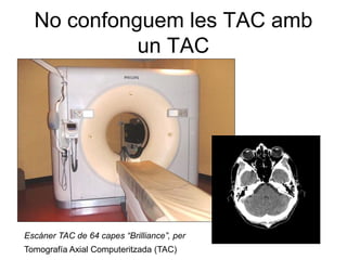 No confonguem les TAC amb
            un TAC




Escáner TAC de 64 capes “Brilliance”, per
Tomografía Axial Computeritzada (TAC)
 