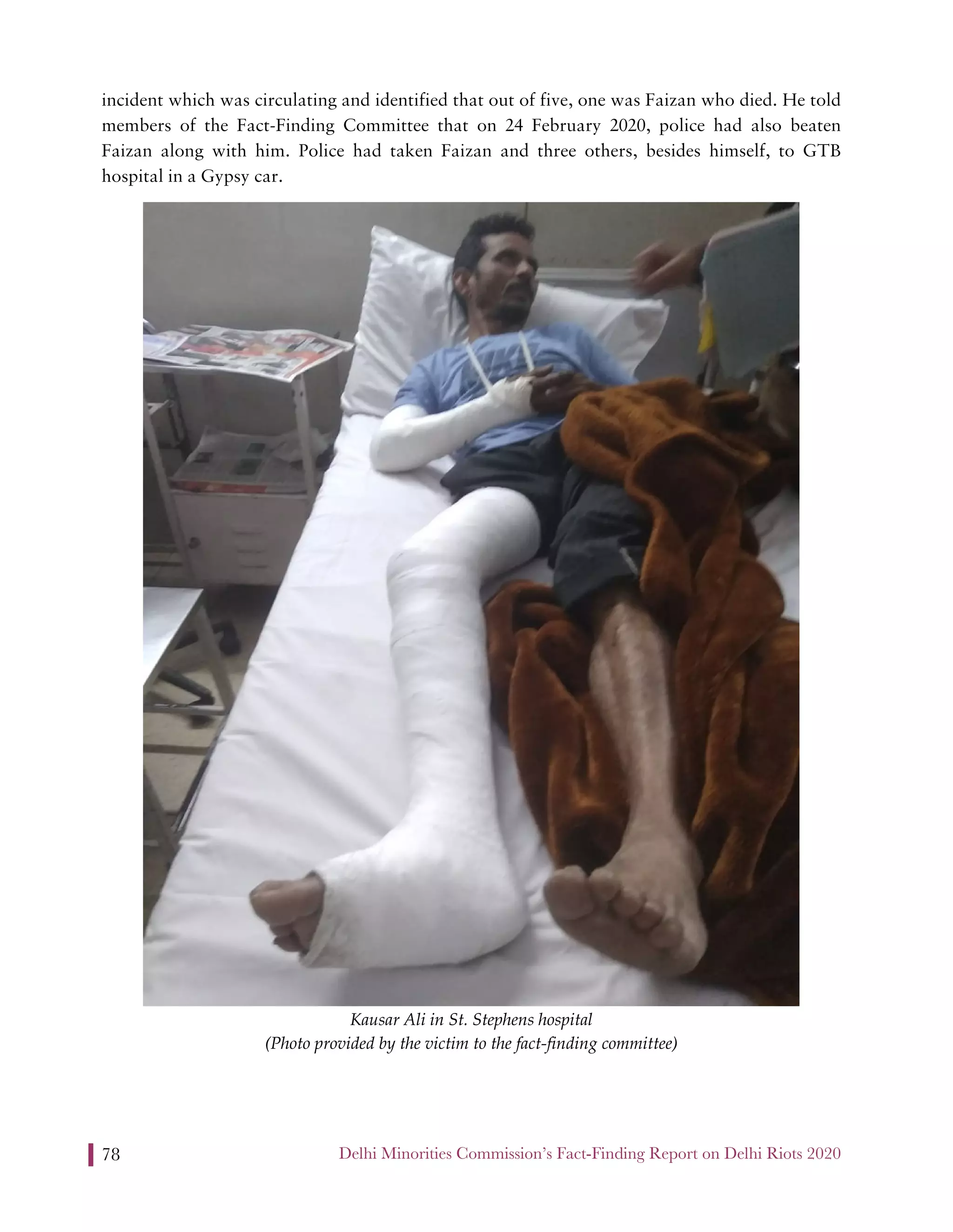 Delhi Minorities Commission’s Fact-Finding Report on Delhi Riots 202078
incident which was circulating and identified that out of five, one was Faizan who died. He told
members of the Fact-Finding Committee that on 24 February 2020, police had also beaten
Faizan along with him. Police had taken Faizan and three others, besides himself, to GTB
hospital in a Gypsy car.
Kausar Ali in St. Stephens hospital
(Photo provided by the victim to the fact-finding committee)
 