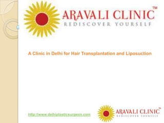 A Clinic in Delhi for Hair Transplantation and Liposuction




http://www.delhiplasticsurgeon.com
 
