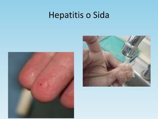 Hepatitis o Sida
 