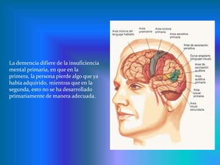Desorientación más tardía durante la enfermedad, por lo general, después de meses o años