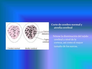 Cambios fisiológicos menos notorios