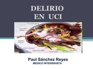 DELIRIO
  EN UCI




Paul Sánchez Reyes
  MEDICO INTENSIVISTA
 