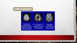 PRUEBAS DE DIAGNOSTICO
 