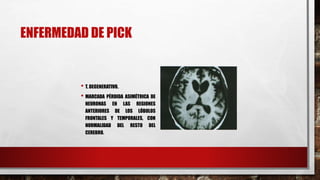 ENFERMEDAD DE PICK
• T. DEGENERATIVO.
• MARCADA PÉRDIDA ASIMÉTRICA DE
NEURONAS EN LAS REGIONES
ANTERIORES DE LOS LÓBULOS
FRONTALES Y TEMPORALES, CON
NORMALIDAD DEL RESTO DEL
CEREBRO.
 