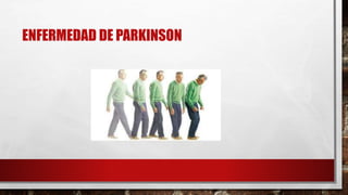 ENFERMEDAD DE PARKINSON
 