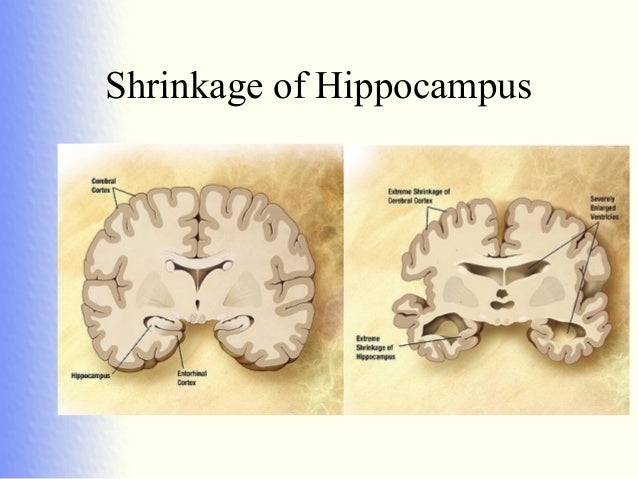 Delirium, dementia, depression
