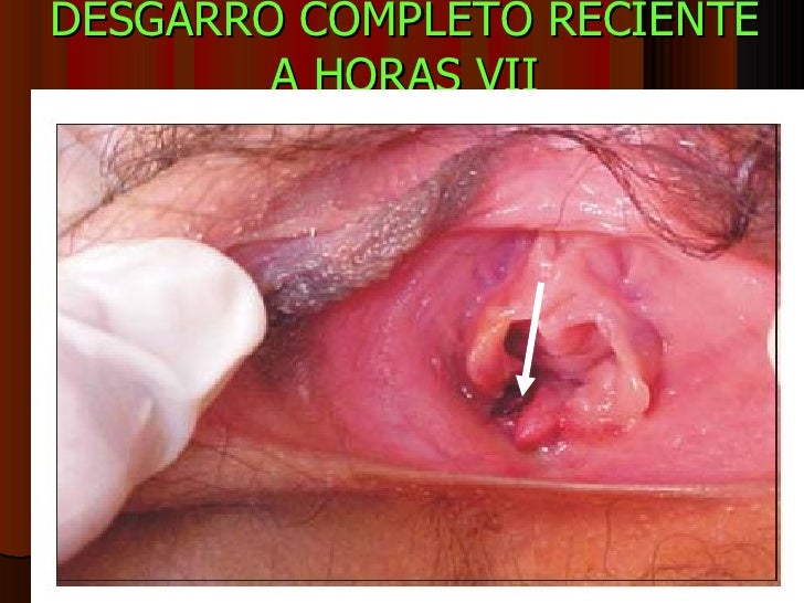 himen sacudidas himen sacudidas