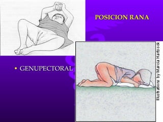 POSICION RANA GENUPECTORAL 
