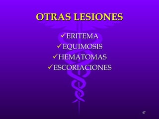 OTRAS LESIONES ERITEMA EQUIMOSIS HEMATOMAS ESCORIACIONES 