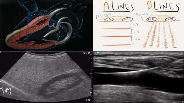 Ultrasound Courses And Training In Chennai, India