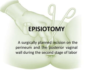 EPISIOTOMY
A surgically planned incision on the
perineum and the posterior vaginal
wall during the second stage of labor
 