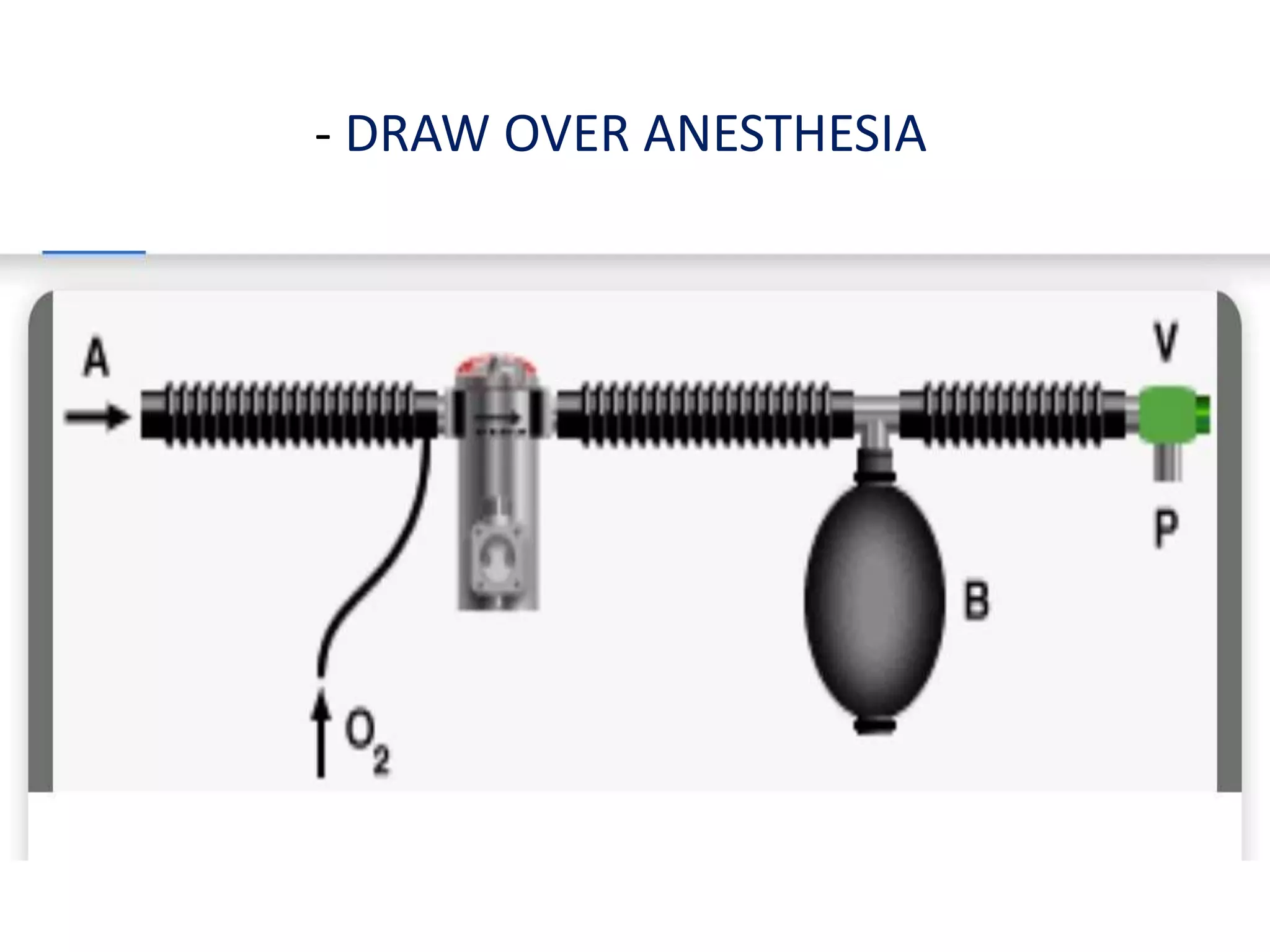 #Delivery of anesthetic agents | PPTX